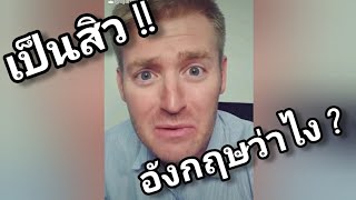 เป็นสิว ภาษาอังกฤษว่าอย่างไร ?? Acne ไม่ใช้แอคเน่ !!